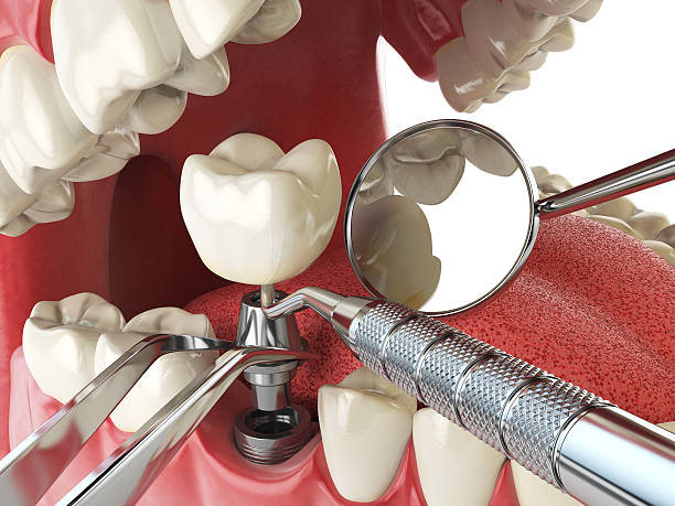 Best Emergency Treatment for Toothache in Madison, AL
